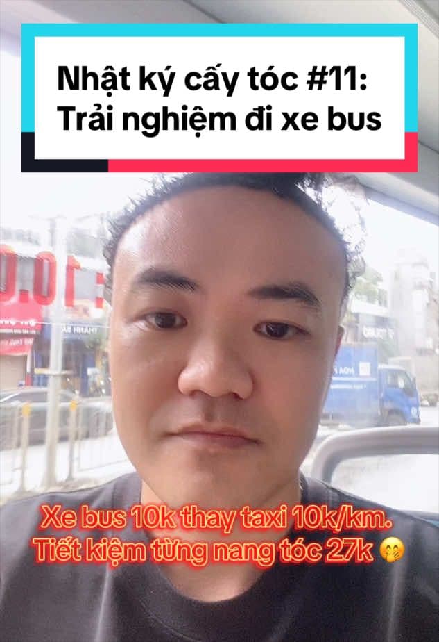 Đi xe bus thay taxi ngày 11 sau cấy tóc